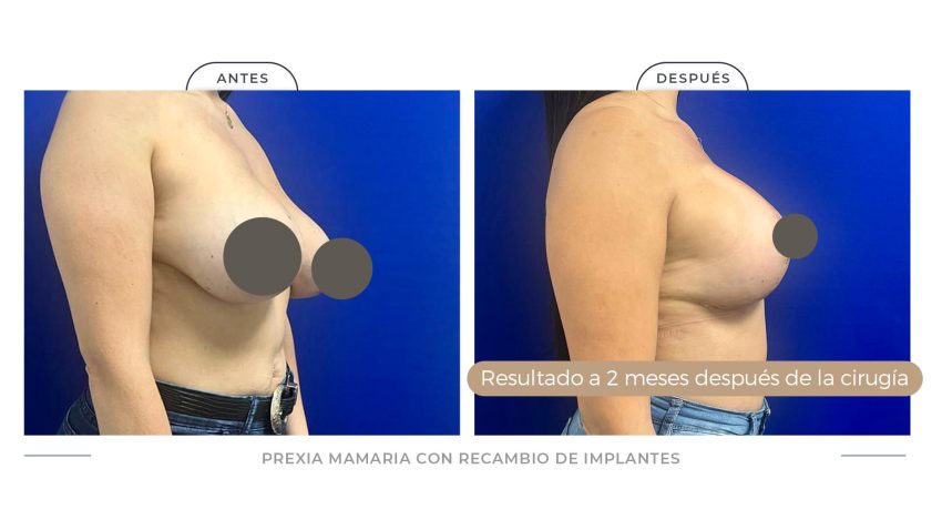 Pexia_PANTALLA_AD3 copia